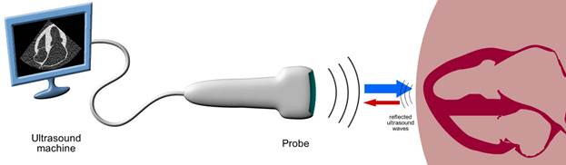 Ultrasound Principles | VirtualEcho Echocardiography Simulator